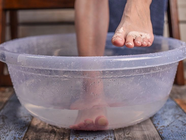 Home Remedies for Athlete’s Foot, Plus How to Stop It from Coming Back