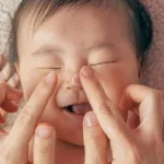 Natural Remedies for Impetigo You Can Do at Home