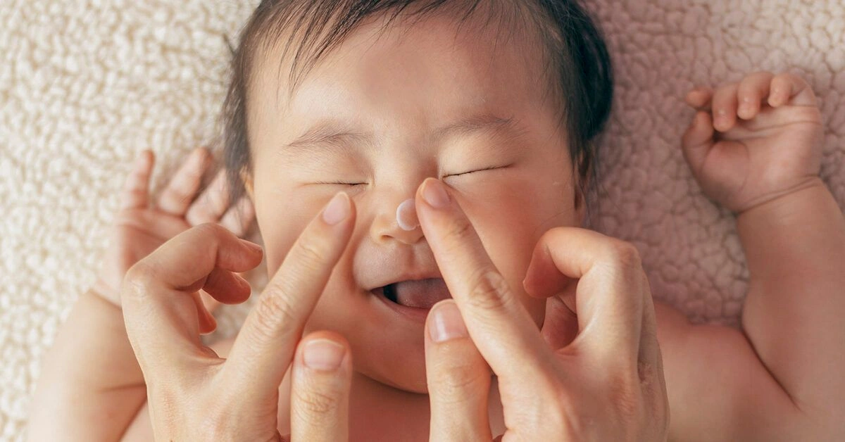 Natural Remedies for Impetigo You Can Do at Home