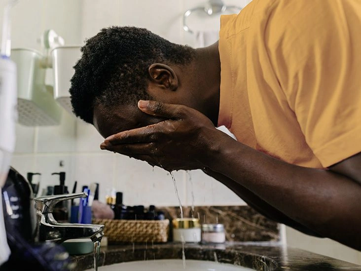 10 Home Remedies for Oily Skin