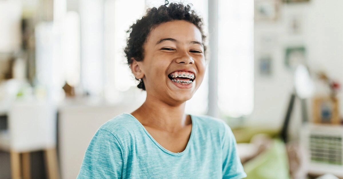 How Long Do Braces Take?