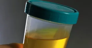 How Long Does Meth Stay in Your Urine?