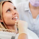How Long Do Veneers Last — Expected Lifespan