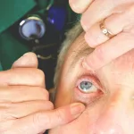How Long Does It Take for the Effects from Eye Dilation Drops to Wear Off?