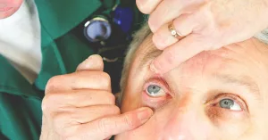 How Long Does It Take for the Effects from Eye Dilation Drops to Wear Off?