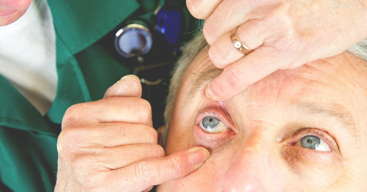 How Long Does It Take for the Effects from Eye Dilation Drops to Wear Off?