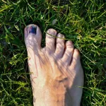 How Long Does It Take for a Toenail to Grow Back?