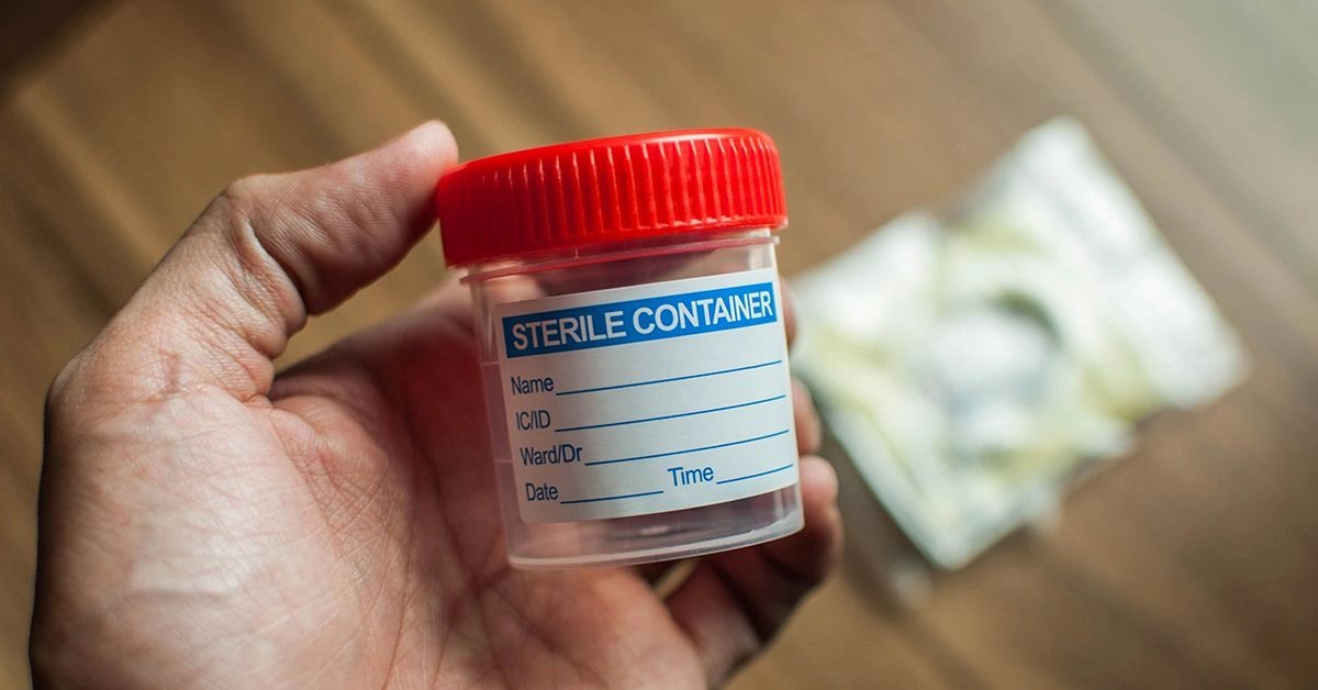 How Long Does Molly (MDMA) Stay in Your System?