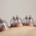 How often should you do cupping for weight loss?