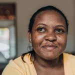 Top Treatments and Natural Options for Scar Removal Top Treatments and Natural Options for Scar Removal