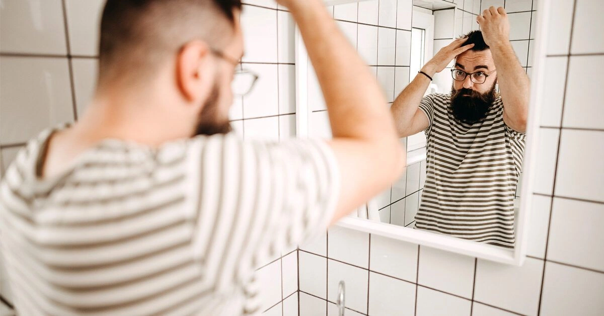 Can I Stop a Receding Hairline? 12 Treatments to Try