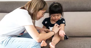 How to Treat Mosquito Bites to Prevent Scarring