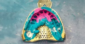 What’s Better: A Dental Implant or a Bridge?