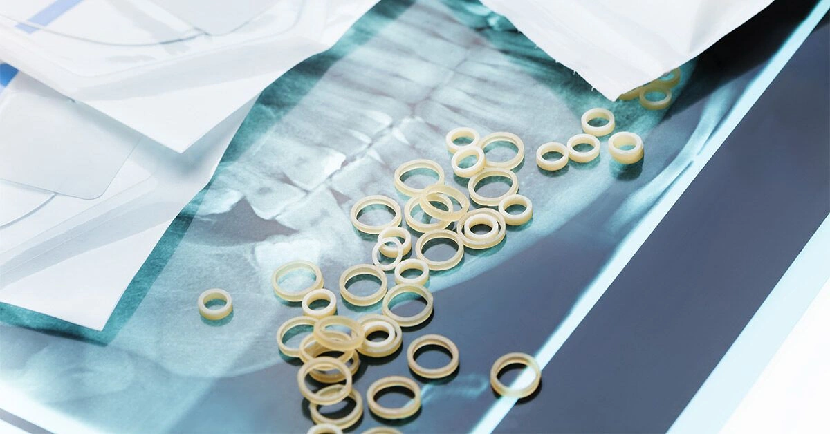 Do You Need to Use Rubber Bands with Invisalign Braces?