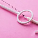 How Does an Intrauterine Device (IUD) Affect Your Period?