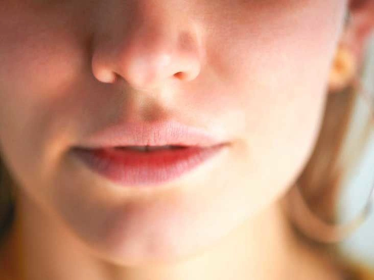 Juvederm: Hyaluronic Acid Dermal Filler