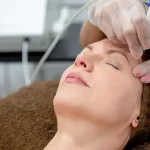 Everything You Want to Know about Laser Genesis for Your Skin