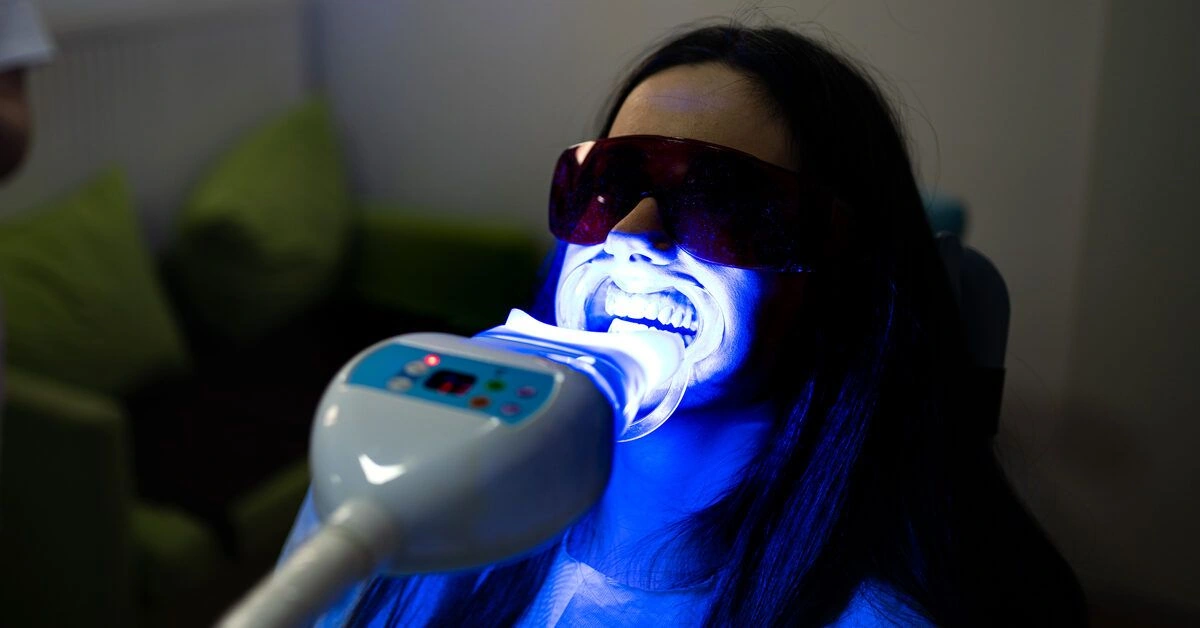 What Is Laser Teeth Whitening?