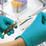 What Causes High Leukocytes in Urine and How Do Doctors Treat it? What Causes High Leukocytes in Urine and How Do Doctors Treat it?