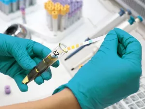 What Causes High Leukocytes in Urine and How Do Doctors Treat it?