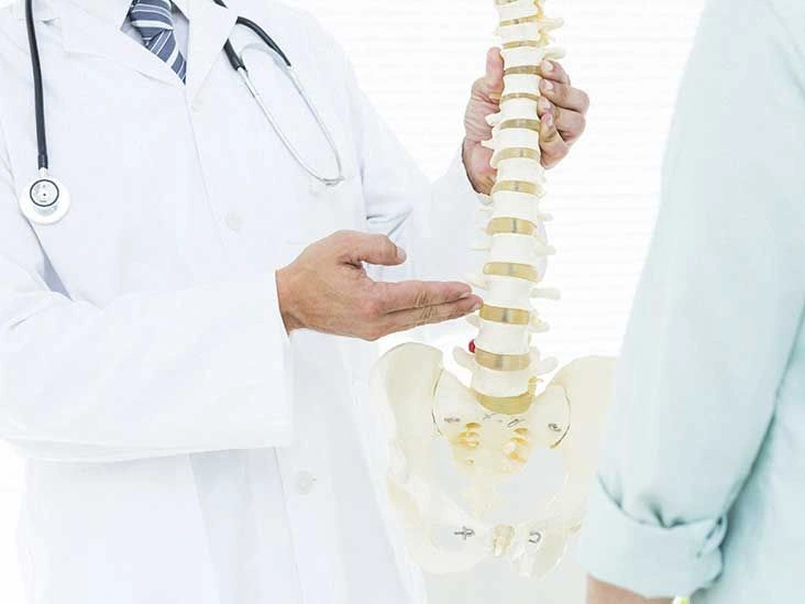 Levoscoliosis: Causes, Symptoms, and Treatment