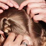 How to Tell the Difference Between Lice and Fleas