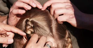 How to Tell the Difference Between Lice and Fleas