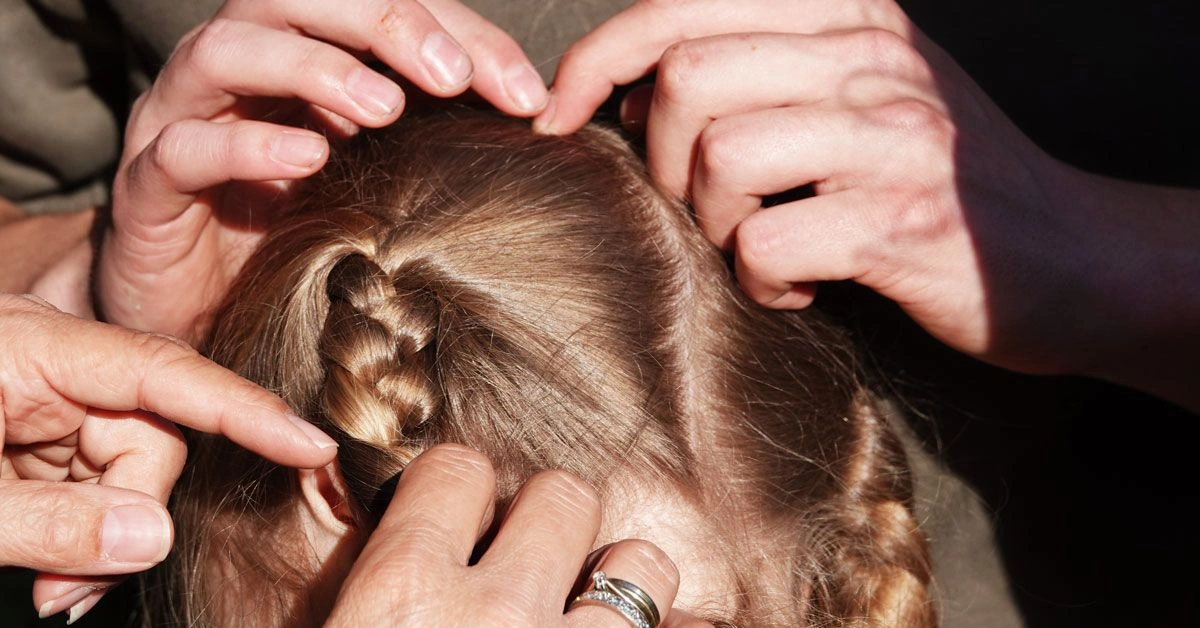 How to Tell the Difference Between Lice and Fleas