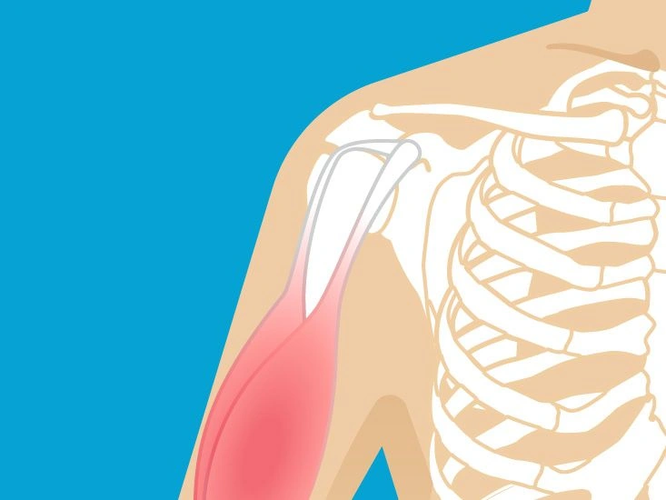 What’s the Difference Between Ligaments and Tendons?