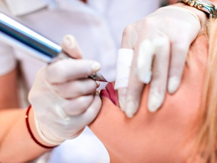 What Is Lip Blushing?