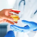 What to Know About a Microalbuminuria Test