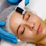 How Much Does Microneedling Cost, and What Factors Into It?
