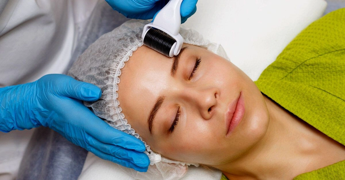 How Much Does Microneedling Cost, and What Factors Into It?
