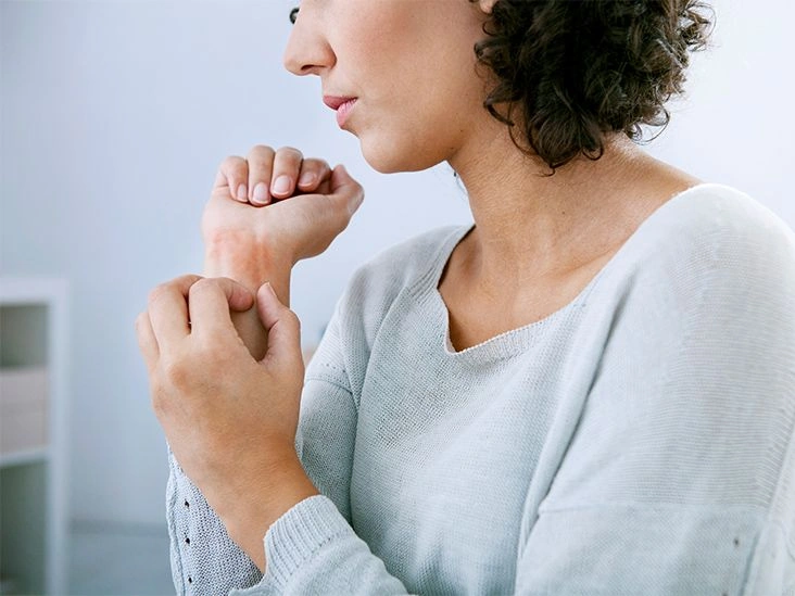 What Do Mite Bites Look Like and How to Treat Them?