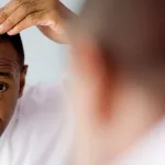 What You Need to Know About NeoGraft Hair Transplants