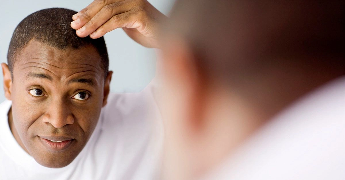What You Need to Know About NeoGraft Hair Transplants