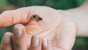 Bee Sting Treatment: 6 Home Remedies Bee Sting Treatment: 6 Home Remedies