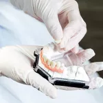 Partial Denture Options & Costs Guide