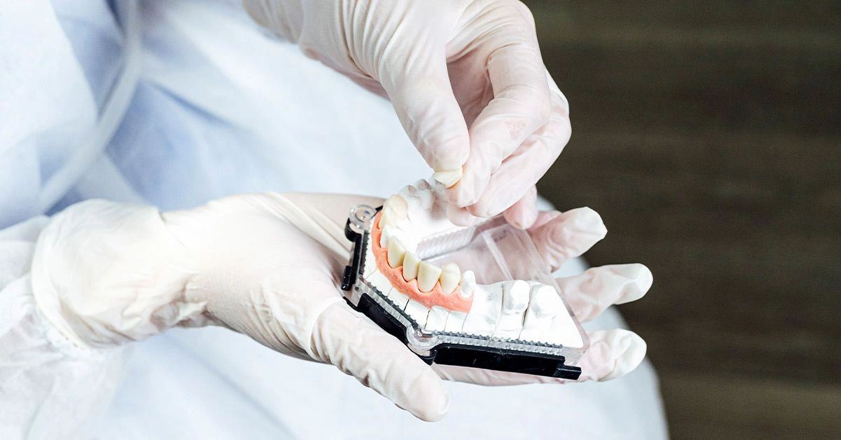Everything You Need to Know About Partial Dentures