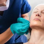 What Is a Polydioxanone (PDO) Thread Lift?