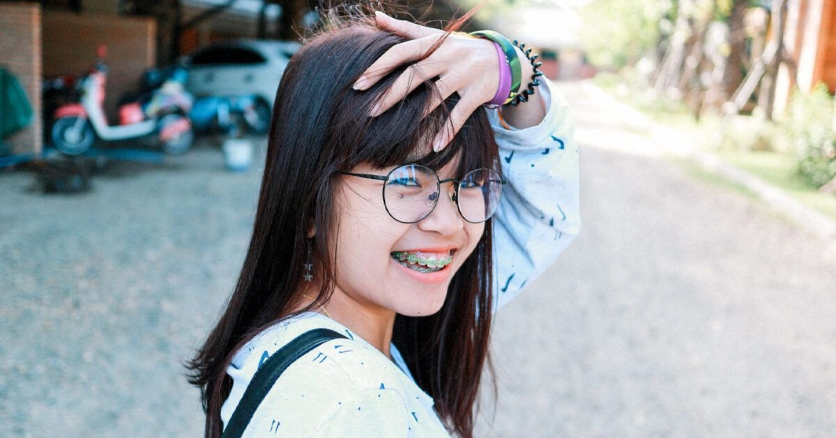 What Are Power Chains for Braces?