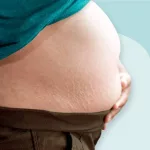 B Belly Pregnancy: Why Your Bump Looks Different