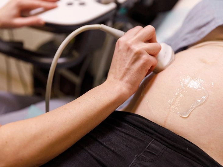 Can a Baby’s Heart Rate Predict Its Sex?