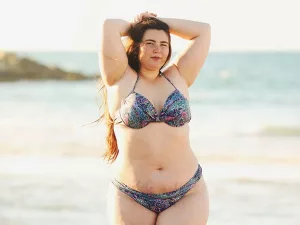 Purple Stretch Marks