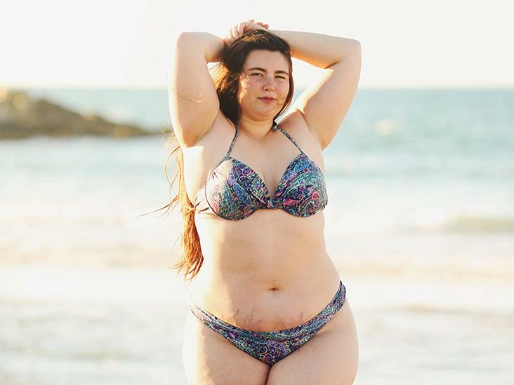 Purple Stretch Marks