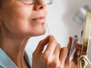 25 Causes of Raised Skin Bumps (with Pictures)