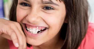 What to Know Before You Get a Retainer