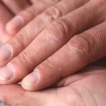 Why Do I Have Ridges in My Fingernails? Why Do I Have Ridges in My Fingernails?