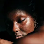 How Rosacea Can Appear Differently on Black Skin How Rosacea Can Appear Differently on Black Skin
