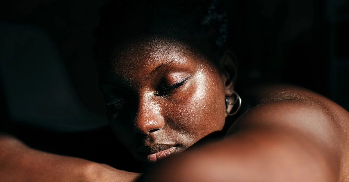 How Rosacea Can Appear Differently on Black Skin